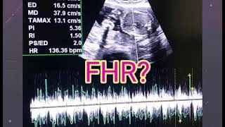 U Tell Me Baby Gender On Ultrasound 🙂  FHRV Cephalic or Breech  Placenta Posterior or Anterior [upl. by Bruce]