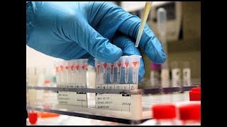 Forward and Reverse method to test blood group in lab  Slide and Tube method [upl. by Waine]