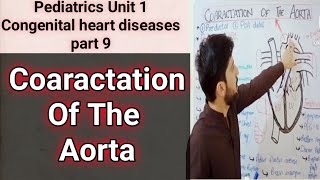 coarctation of the aorta  pre ductal and post ductal  pathophysiology symptoms and treatment [upl. by Taggart]