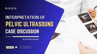 Interpretation of Pelvic Ultrasound Case discussion [upl. by Enixam]