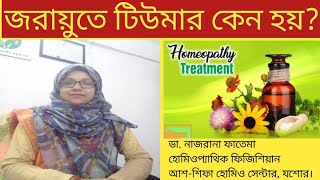 জরায়ুতে টিউমার কেন হয় Uterine fibroids Dr Nazrana Fatema [upl. by Barnabe]