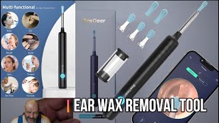 Ear Wax Removal Tool [upl. by Kaylyn]