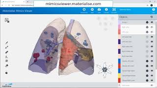 How to View Cases in Mimics Viewer  Materialise Mimics 22 [upl. by Marie762]