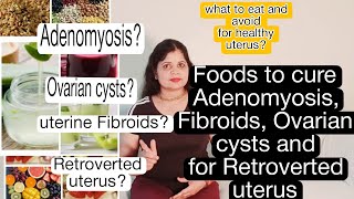 Foods to cure Adenomyosis Fibroids Ovarian cysts Retroverted uterus [upl. by Bethesda]