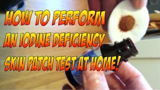 Perform an iodine deficiency skin patch test at home [upl. by Aissej]