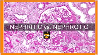 Nephritic vs Nephrotic Syndromes [upl. by Sergo]