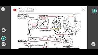 hemochromatosis [upl. by Kano]