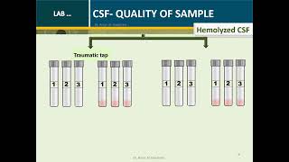 Cerebrospinal fluid Routine Analysis Microbiology Tube 2 [upl. by Amary457]