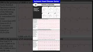 Ischemic Heart Disease 3 Myocardial Infarction STEMI amp NSTEMI [upl. by Maximilianus]