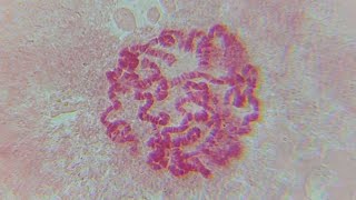 A RAPID EASY amp WORKING PROTOCOL OF POLYTENE CHROMOSOME PREPARATION FROM Drosophila sp LARVA [upl. by Chemesh695]