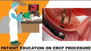 Patient Education On ERCP Procedure [upl. by Eduardo]