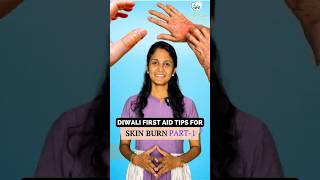 Diwali First Aid Tips For Skin Burn  Must Watch [upl. by Siduhey478]