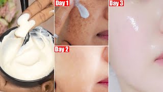 Whitening amp Glowing Winter Face Cream3 Days Skin Brightening Challengeबेजान चेहरे को बनाए चमकदार [upl. by Peery]