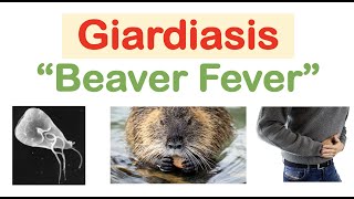 Giardiasis Beaver Fever Infection Sources Pathophysiology Signs amp Symptoms Diagnosis Treatment [upl. by Milburr]