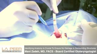 Watch Parathyroidectomy Surgery Performed by Dr Zadeh at La Peer Surgery Center [upl. by Chlores188]