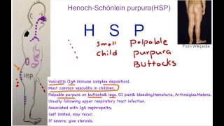 HenochSchönlein Purpura Mnemonic [upl. by Eilime]