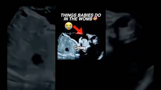 Things babies do in the womb ultrasound pregnancy baby cutebaby womenshealth [upl. by Johns319]