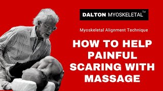 How to Help Painful Scarring with Massage [upl. by Nylrehs132]