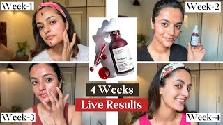 I tried The Ordinary Peeling Solution  4 Weeks Live Results  Garima Verma [upl. by Alekim417]