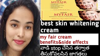 my fair cream review in telugubest skin whitening creamremove pimplesdark spots pigmentation [upl. by Nageam]