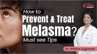 How to treat Prevent Melasma  How to lighten Melasma  Best Pigmentation Treatment in Ludhiana [upl. by Mella422]