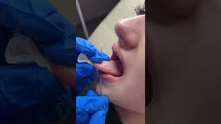 Tongue piercing full process educational [upl. by Ydoow]