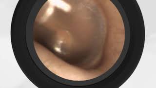 Valsalva ear popping video [upl. by Ahsiym]