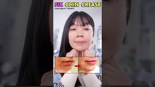 Smooth Chin Massage  Remove Chin lines Chin butt Chin dimpling [upl. by Burtie141]