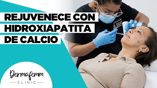 REJUVENECE CON HIDROXIAPATITA DE CALCIO  Bioestimulación natural [upl. by Millda]