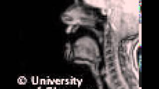 MRI voiced retroflex lateralapproximant [upl. by Ettesil]