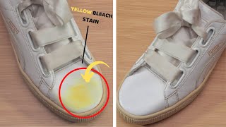 Remove Yellow Bleach Stains from White Shoes amp Clean Them Using Baking Soda amp Vinegar [upl. by Husch]