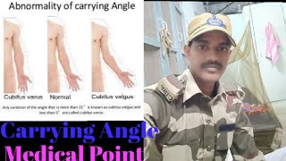 SSC GD Medical Carrying Angle Check Up  SSC GD carry angle very dangerous medical point [upl. by Perpetua]