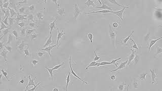 Teaching cell biology with livecell imaging contamination in a HeLa cell culture  CytoSMART Lux2 [upl. by Dressler]