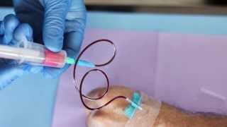 Drawing Blood using a Butterfly Needle [upl. by Tager]