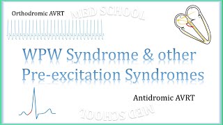 WPW Syndrome amp other preexcitation syndromes [upl. by Sirap]