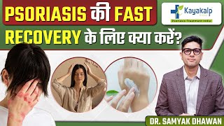 Psoriasis की Fastest Recovery के लिए 5 बहतरीन Tips  5 Tips for Psoriasis Fastest Recovery [upl. by Sevein493]