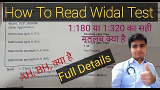 Widal Test । How To Read Report Enteric Fever Report  Be Your Best Doctor [upl. by Stanly219]