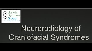 Neuroradiology of Craniofacial Syndromes craniosynostosis and beyond [upl. by Hardi724]