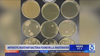 Antibioticresistant super bacteria found for the first time in Los Angeles County [upl. by Sirah14]