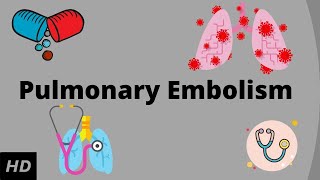 Pulmonary embolism Causes Signs and Symptoms Diagnosis and Treatment [upl. by Danica]