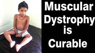 muscular dystrophy treatment in ayurveda  duchenne muscular dystrophy ayurvedic treatment [upl. by Suter393]