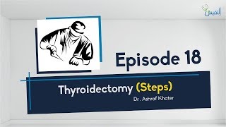 Thyroidectomy Steps 02  Surgery  Prof Ashraf Khater [upl. by Joaquin]