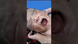 Look at the Full Vernix on Face and Body Of The New Baby BornCleaning Process With Oil youtuber [upl. by Nord]