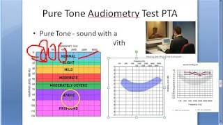 ENT 041 a Pure Tone Audiometry PTA test [upl. by Isyad]