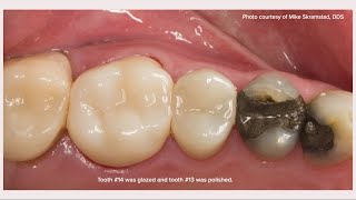 Zirconia 101 2 of 11 What is KATANA Zirconia [upl. by Nahtanohj641]