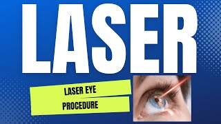 LASER SA MATA LASER EYE PROCEDURE [upl. by Metzger]