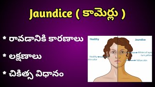 Jaundice  పచ్చ కామెర్లు  Causes Symptoms and Treatment in Telugu [upl. by Comptom]