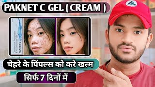 Paknet c gel uses dose benefits and Side effects full review in hindi [upl. by Zima664]