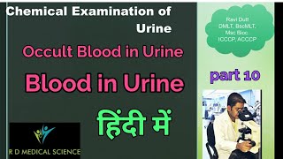 Blood in UrineOccult blood कारणchemical Examination ofurineBenzidine method of OB [upl. by Dnomde]