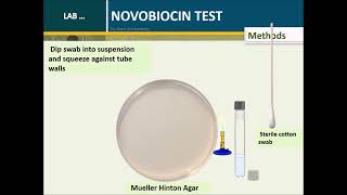 Novobiocin test Coagulase Negative Staphylococci S epidermidis and S saprophyticusversion 02 [upl. by Nada]